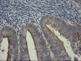 m04067 anti serpinb3 mouse monoclonal antibody clone id oti3c2 ihc testing 4