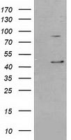 HEK293T cells were transfected with the pCMV6-ENTRY control (Left lane) or pCMV6-ENTRY SERPINB3 (Right lane) cDNA for 48 hrs and lysed