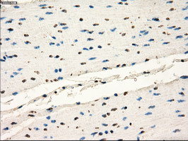 m04075 1 anti frk mouse monoclonal antibody clone id oti6d2 ihc testing 6