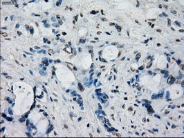 m04075 1 anti frk mouse monoclonal antibody clone id oti6d2 ihc testing 7