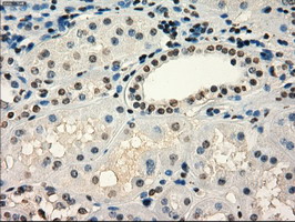 m04075 1 anti frk mouse monoclonal antibody clone id oti6d2 ihc testing 8