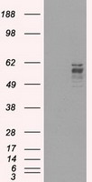 HEK293T cells were transfected with the pCMV6-ENTRY control (Left lane) or pCMV6-ENTRY FRK (Right lane) cDNA for 48 hrs and lysed