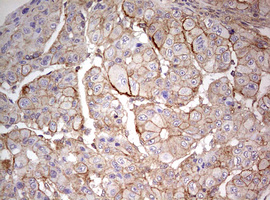 m04080 anti arl3 mouse monoclonal antibody clone id oti1c6 ihc testing 5
