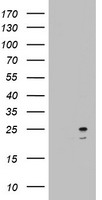 HEK293T cells were transfected with the pCMV6-ENTRY control (Left lane) or pCMV6-ENTRY ARL3 (Right lane) cDNA for 48 hrs and lysed