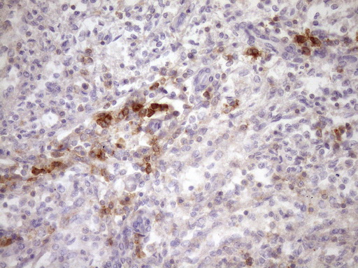 m04083 anti slamf7 mouse monoclonal antibody clone id oti3b3 ihc testing 3