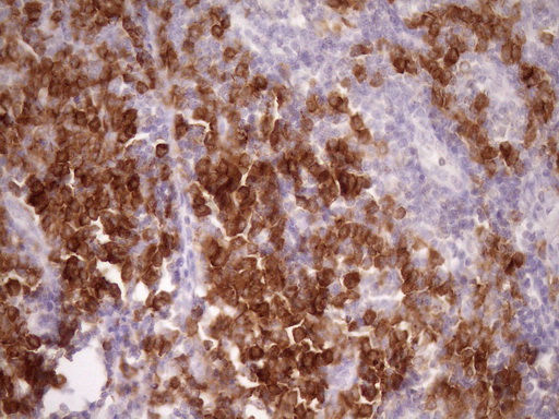m04083 anti slamf7 mouse monoclonal antibody clone id oti3b3 ihc testing 4