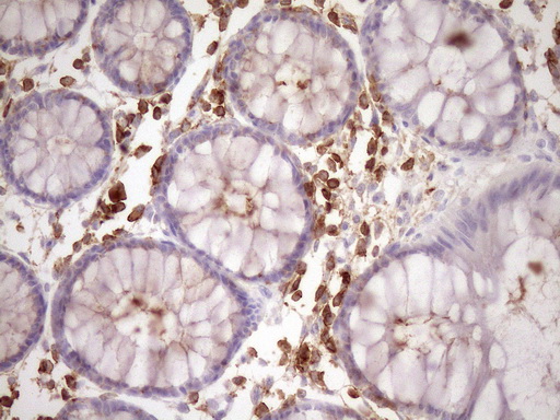 m04083 anti slamf7 mouse monoclonal antibody clone id oti3b3 ihc testing 5