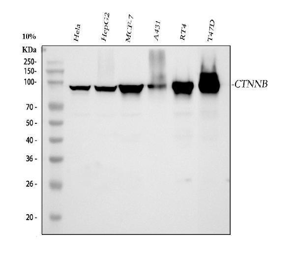 m04085 1 ctnnb1 primary antibodies wb testing 1