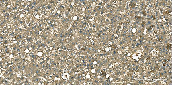  IHC analysis of Aspartate Aminotransferase/GOT1 using anti-Aspartate Aminotransferase/GOT1 antibody (M04085-1)