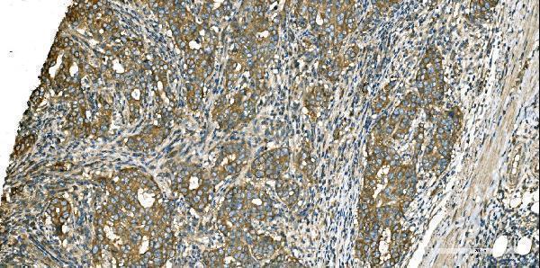  IHC analysis of Aspartate Aminotransferase/GOT1 using anti-Aspartate Aminotransferase/GOT1 antibody (M04085-1)