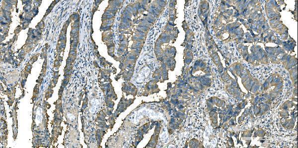 m04085 1 got1 primary antibodies ihc testing 4