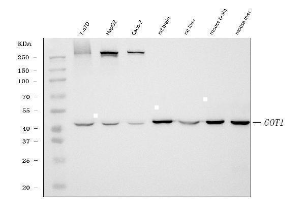  Western blot analysis of Aspartate Aminotransferase/GOT1 using anti-Aspartate Aminotransferase/GOT1 antibody (M04085-1)