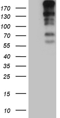 m04095 anti cenpj mouse monoclonal antibody clone id oti3g8 wb testing 1