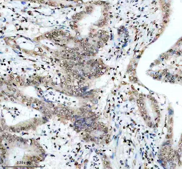 IHC analysis of CIRBP using anti-CIRBP antibody (M04103)