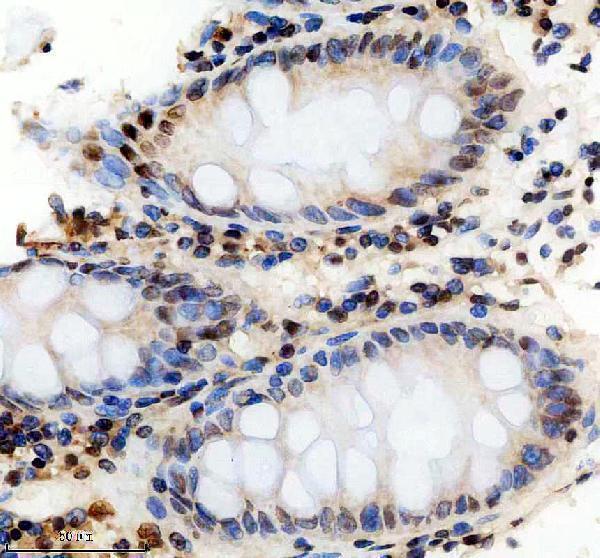IHC analysis of CIRBP using anti-CIRBP antibody (M04103)