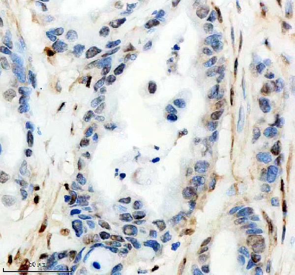 m04103 cirbp primary antibodies ihc testing 3