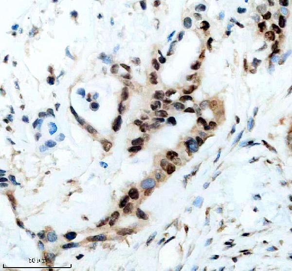 m04103 cirbp primary antibodies ihc testing 4