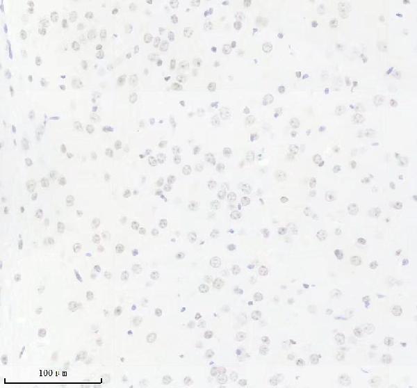 m04103 cirbp primary antibodies ihc testing 5