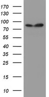 HEK293T cells were transfected with the pCMV6-ENTRY control (Left lane) or pCMV6-ENTRY SPG7 (Right lane) cDNA for 48 hrs and lysed