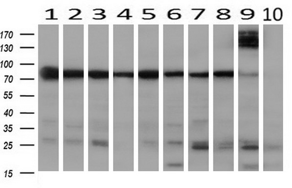 Western blot analysis of extracts (10ug) from 10 Human tissue by using anti-SPG7 monoclonal antibody at 1:200 (1: Testis; 2: Omentum; 3: Uterus; 4: Breast; 5: Brain; 6: Liver; 7: Ovary; 8: Thyroid gland; 9: colon;10: spleen)
