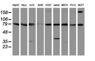 Western blot analysis of extracts (35ug) from 9 different cell lines by using anti-SPG7 monoclonal antibody