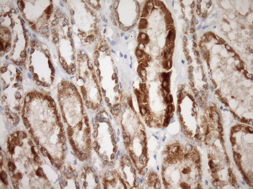 m04108 anti stoml2 mouse monoclonal antibody clone id oti1f5 ihc testing 12