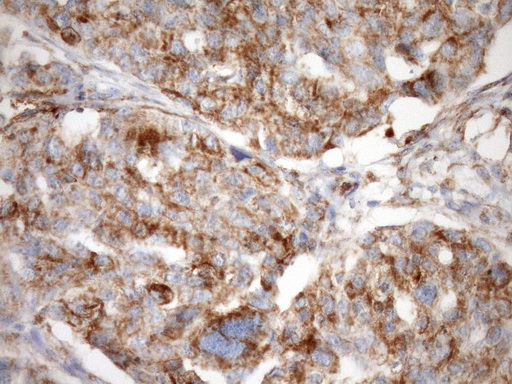 m04108 anti stoml2 mouse monoclonal antibody clone id oti1f5 ihc testing 2