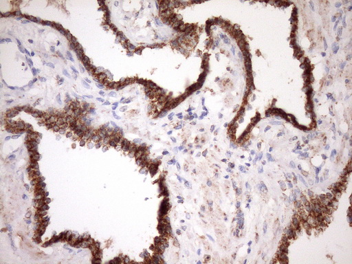 m04108 anti stoml2 mouse monoclonal antibody clone id oti1f5 ihc testing 6