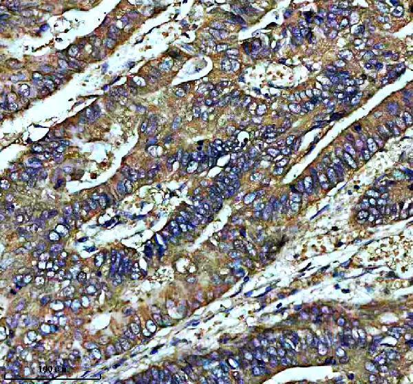 IHC analysis of CAPNS1 using anti-CAPNS1 antibody (M04111-1)