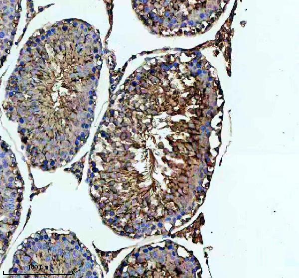 IHC analysis of CAPNS1 using anti-CAPNS1 antibody (M04111-1)