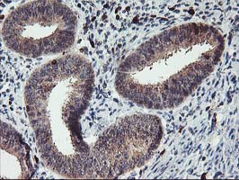 Immunohistochemical staining of paraffin-embedded Human endometrium tissue within the normal limits using anti-GRAP2 mouse monoclonal antibody