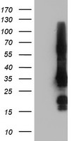 HEK293T cells were transfected with the pCMV6-ENTRY control (Left lane) or pCMV6-ENTRY GRAP2 (Right lane) cDNA for 48 hrs and lysed