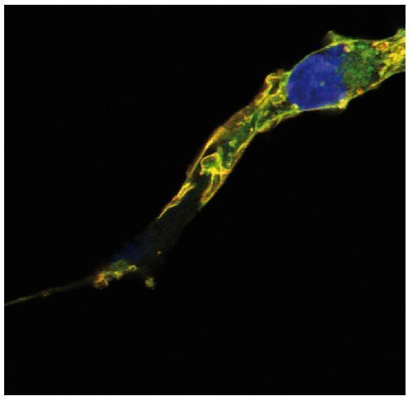 Immunocytochemistry analysis of colocalization of R-Ras2/TC21 signal (red) and GFP signal (green) in COS cells transfected with R-Ras2/TC21-GFP construct, after fixation and permeabilization