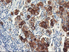 m04118 anti dpp10 mouse monoclonal antibody clone id oti1a5 ihc testing 2