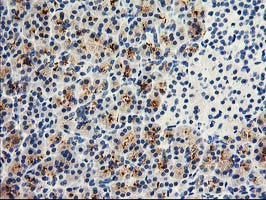 m04118 anti dpp10 mouse monoclonal antibody clone id oti1a5 ihc testing 3