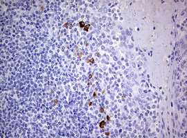 m04122 anti tgif tgif1 mouse monoclonal antibody clone id oti1b12 ihc testing 4