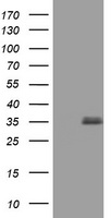 HEK293T cells were transfected with the pCMV6-ENTRY control (Left lane) or pCMV6-ENTRY TGIF1 (Right lane) cDNA for 48 hrs and lysed
