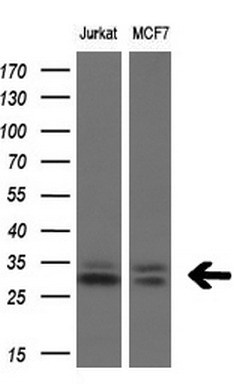 Western blot analysis of extracts (10ug) from 2 different cell lines by using anti-TGIF1 monoclonal antibody at 1:200 dilution