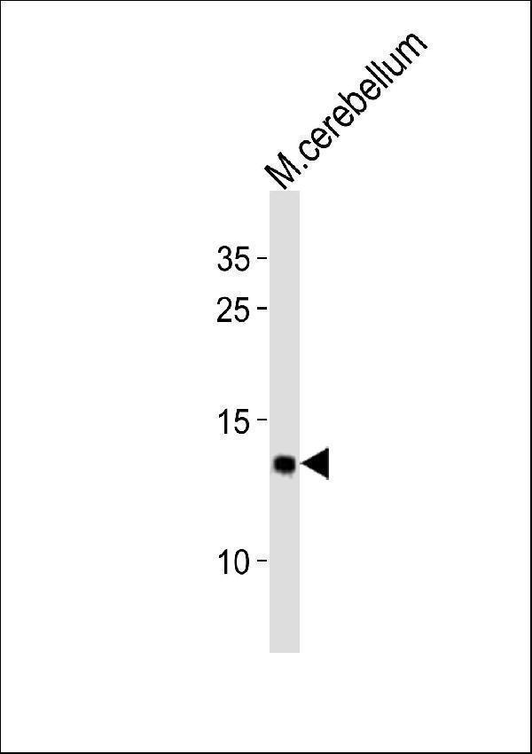 m04125 anti eif1 antibody c term wb testing 2
