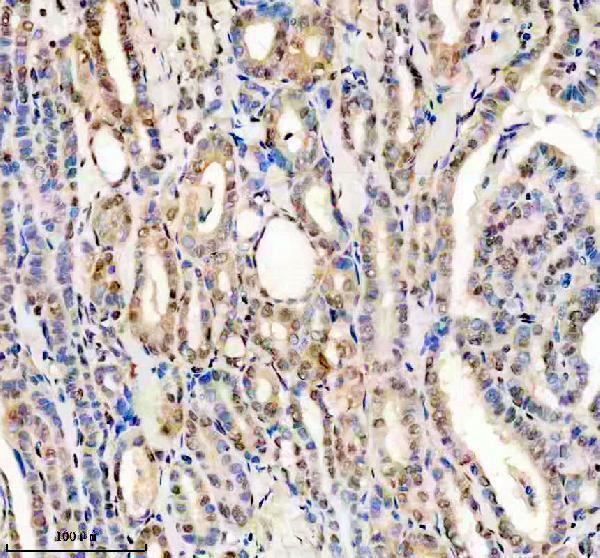 IHC analysis of KDM4B using anti-KDM4B antibody (M04127)