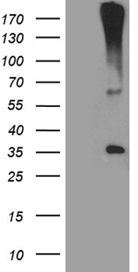 HEK293T cells were transfected with the pCMV6-ENTRY control (Left lane) or pCMV6-ENTRY HSD17B3 (Right lane) cDNA for 48 hrs and lysed