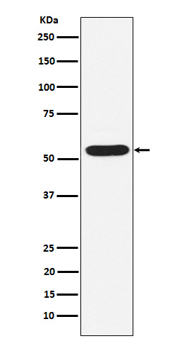 Western blot analysis of PIAS2 expression in HepG2 cell lysate