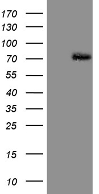 HEK293T cells were transfected with the pCMV6-ENTRY control (Left lane) or pCMV6-ENTRY PIAS2 (Right lane) cDNA for 48 hrs and lysed