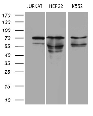 Western blot analysis of extracts (35ug) from 3 different cell lines by using anti-PIAS2 monoclonal antibody
