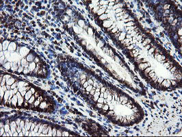 m04131 anti snon skil mouse monoclonal antibody clone id oti2f6 ihc testing 10