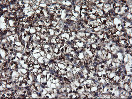 m04131 anti snon skil mouse monoclonal antibody clone id oti2f6 ihc testing 11