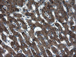 m04131 anti snon skil mouse monoclonal antibody clone id oti2f6 ihc testing 12
