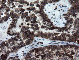 m04131 anti snon skil mouse monoclonal antibody clone id oti2f6 ihc testing 3