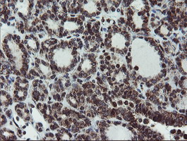 m04131 anti snon skil mouse monoclonal antibody clone id oti2f6 ihc testing 4