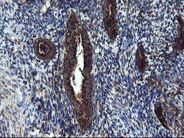 m04131 anti snon skil mouse monoclonal antibody clone id oti2f6 ihc testing 5